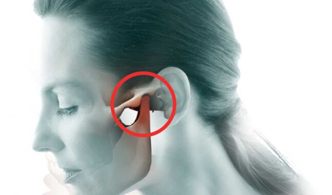 DTM e Dor Orofacial